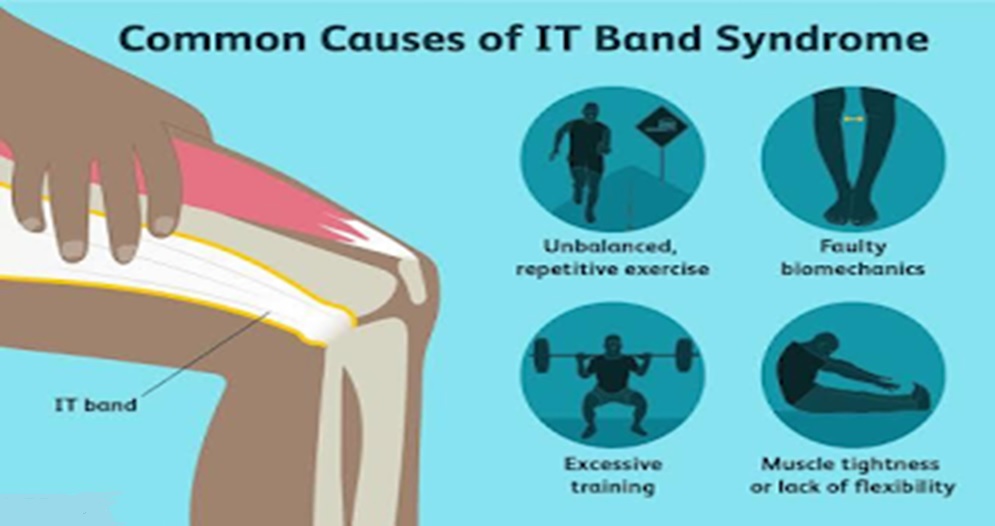 Common causes of it band syndrome